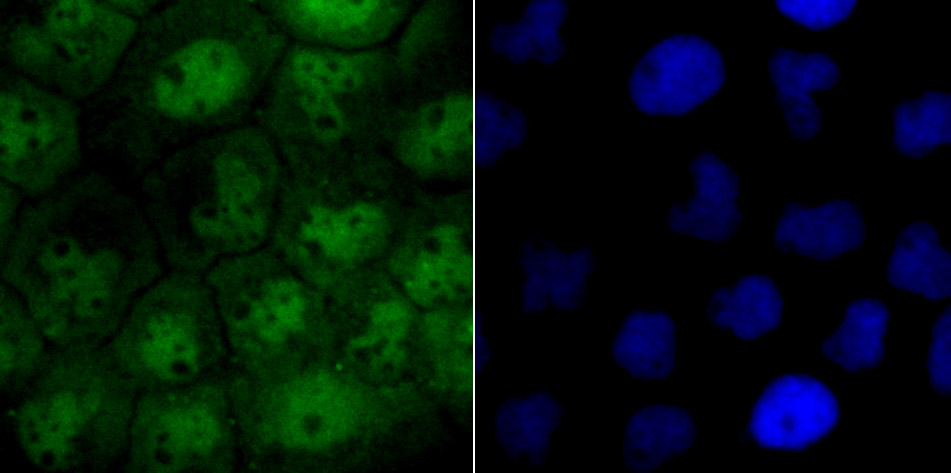 IF(ICC) staining with Exportin-1 (2C4) Monoclonal Antibody (bsm-54273R) at 1:100 in A431 cells (green). The nuclear counterstain is DAPI (blue). Cells were fixed in paraformaldehyde, permeabilized with 0.25% Triton X100/PBS.