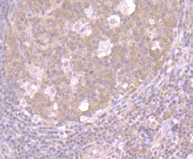 Paraformaldehyde-fixed and paraffin-embedded Human Tonsil tissue incubated with Exportin-1 (2C4) Monoclonal Antibody (bsm-54273R) at 1:100, overnight at 4°C, followed by a conjugated secondary antibody and DAB staining. Counterstained with hematoxylin.