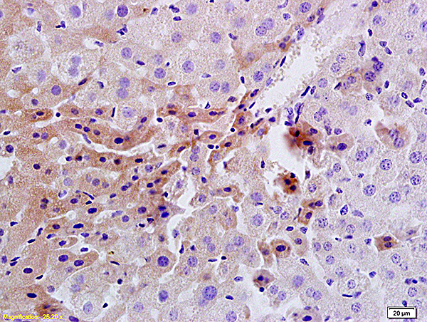 Formalin-fixed and paraffin embedded rat liver tissue labeled Anti-Insulin Receptor/CD220 Polyclonal Antibody, Unconjugated (bs-0681R) at 1:200, followed by conjugation to the secondary antibody and DAB staining