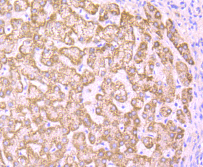 Paraformaldehyde-fixed and paraffin-embedded Human Liver tissue incubated with PCK2 (12C5) Monoclonal Antibody (bsm-54275R) at 1:100, overnight at 4°C, followed by a conjugated secondary antibody and DAB staining. Counterstained with hematoxylin.