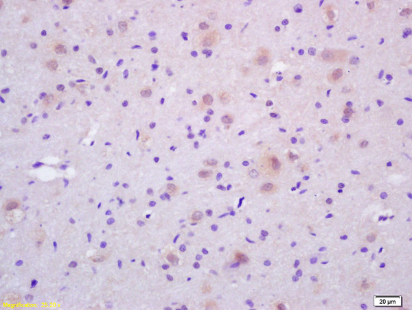 Formalin-fixed and paraffin embedded rat brain labeled with Rabbit Anti CDC37 Polyclonal Antibody, Unconjugated (bs-4290R) at 1:200 followed by conjugation to the secondary antibody and DAB staining