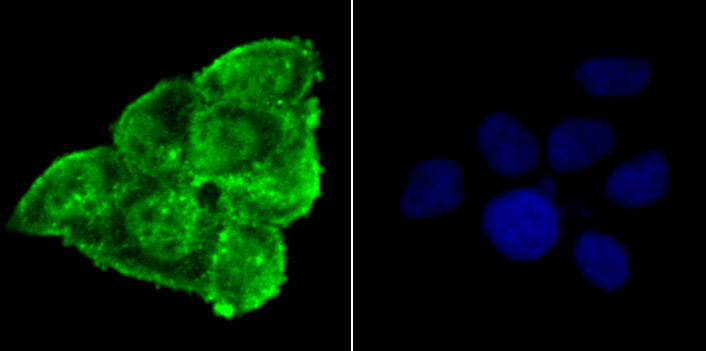 IF(ICC) staining with Phospho-alpha Synuclein (Ser129) (3G7) Monoclonal Antibody (bsm-54276R) at 1:100 in Hela cells (green). The nuclear counterstain is DAPI (blue). Cells were fixed in paraformaldehyde, permeabilized with 0.25% Triton X100/PBS.