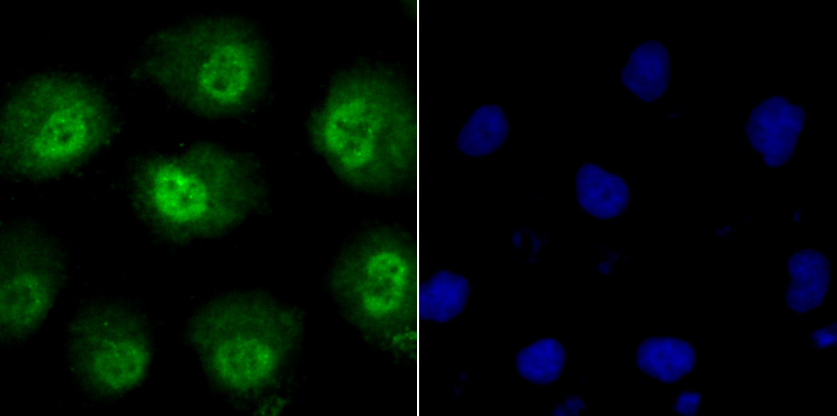 IF(ICC) staining with Phospho-alpha Synuclein (Ser129) (3G7) Monoclonal Antibody (bsm-54276R) at 1:100 in HUVEC cells (green). The nuclear counterstain is DAPI (blue). Cells were fixed in paraformaldehyde, permeabilized with 0.25% Triton X100/PBS.