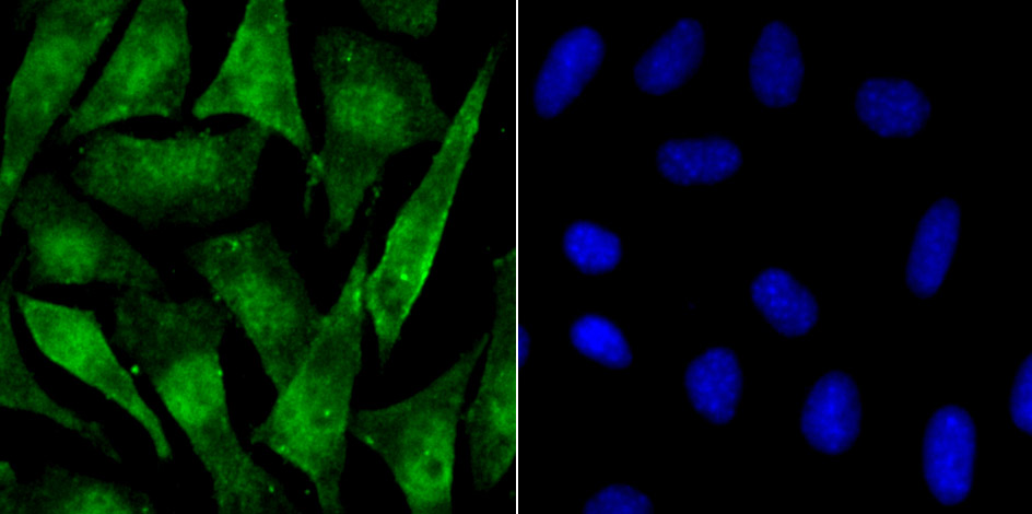IF(ICC) staining with Phospho-alpha Synuclein (Ser129) (3G7) Monoclonal Antibody (bsm-54276R) at 1:100 in SH-SY5Y cells (green). The nuclear counterstain is DAPI (blue). Cells were fixed in paraformaldehyde, permeabilized with 0.25% Triton X100/PBS.