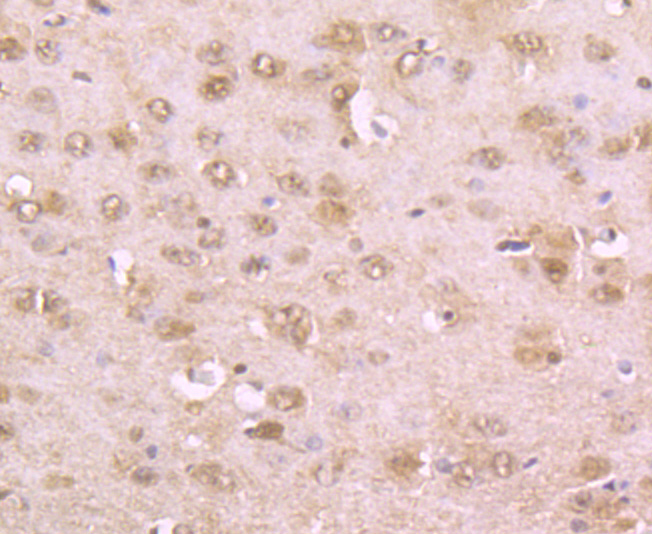 Paraformaldehyde-fixed and paraffin-embedded Rat Brain tissue incubated with Phospho-alpha Synuclein (Ser129) (3G7) Monoclonal Antibody (bsm-54276R) at 1:100, overnight at 4°C, followed by a conjugated secondary antibody and DAB staining. Counterstained with hematoxylin.
