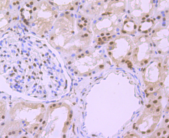 Paraformaldehyde-fixed and paraffin-embedded Human Kidney tissue incubated with Phospho-alpha Synuclein (Ser129) (3G7) Monoclonal Antibody (bsm-54276R) at 1:100, overnight at 4°C, followed by a conjugated secondary antibody and DAB staining. Counterstained with hematoxylin.