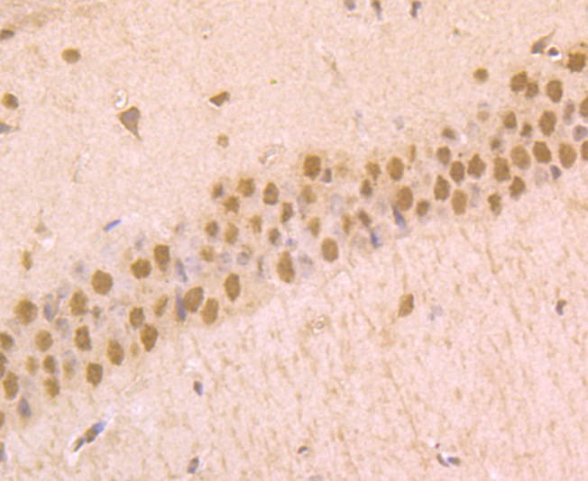 Paraformaldehyde-fixed and paraffin-embedded Mouse Brain tissue incubated with Phospho-alpha Synuclein (Ser129) (3G7) Monoclonal Antibody (bsm-54276R) at 1:100, overnight at 4°C, followed by a conjugated secondary antibody and DAB staining. Counterstained with hematoxylin.