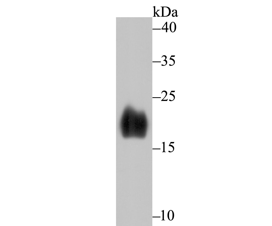 Lane 1: Human Fetal Brain; Probed with Alpha Synuclein (3H12) Monoclonal Antibody (bsm-54277R) at 1:500 overnight at 4°C followed by a conjugated secondary antibody for 60 minutes at 37°C.