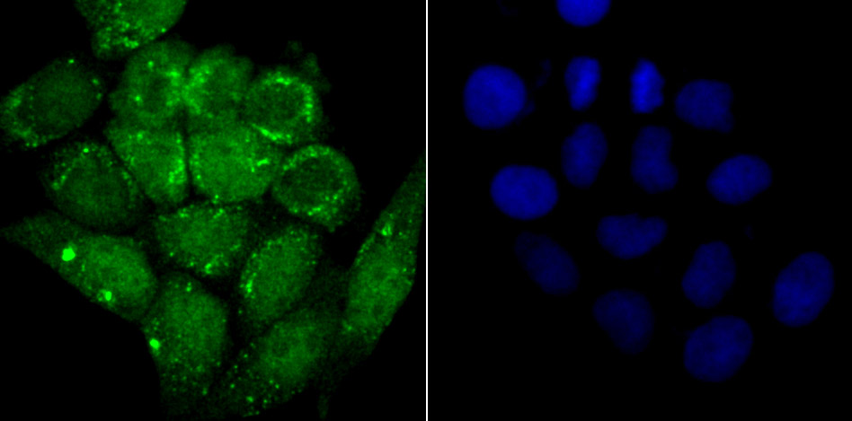 IF(ICC) staining with Alpha Synuclein (3H12) Monoclonal Antibody (bsm-54277R) at 1:100 in Hela cells (green). The nuclear counterstain is DAPI (blue). Cells were fixed in paraformaldehyde, permeabilized with 0.25% Triton X100/PBS.