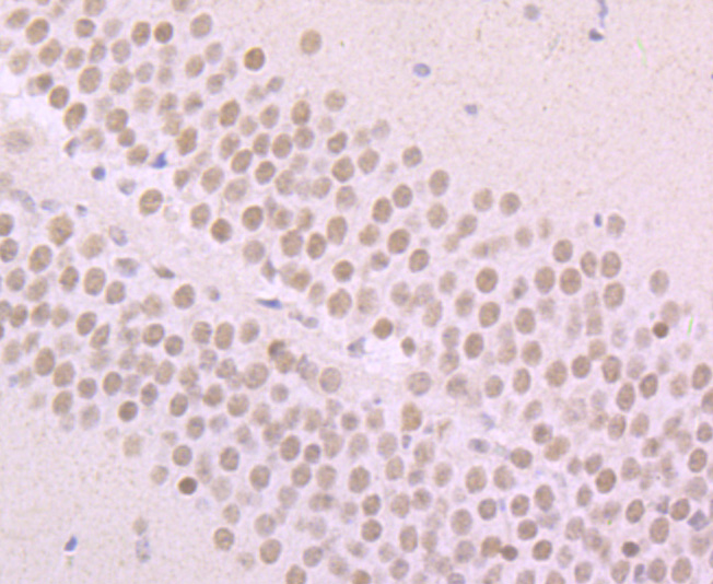 Paraformaldehyde-fixed and paraffin-embedded Mouse Brain tissue incubated with Alpha Synuclein (3H12) Monoclonal Antibody (bsm-54277R) at 1:100, overnight at 4°C, followed by a conjugated secondary antibody and DAB staining. Counterstained with hematoxylin.