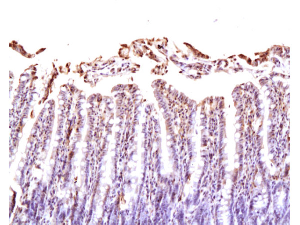 Formalin-fixed and paraffin embedded rat small intestine labeled Anti-NRP1\/CD304 Polyclonal Antibody, Unconjugated (bs-0693R) at 1:200, followed by conjugation to the secondary antibody and DAB staining