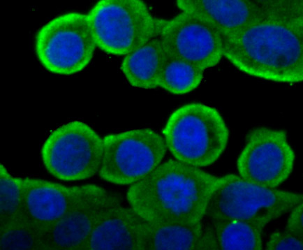 IF(ICC) staining with Cytochrome P450 Oxidoreductase (4F7) Monoclonal Antibody (bsm-54281R) at 1:100 in LOVO cells (green). The nuclear counterstain is DAPI (blue). Cells were fixed in paraformaldehyde, permeabilized with 0.25% Triton X100/PBS.