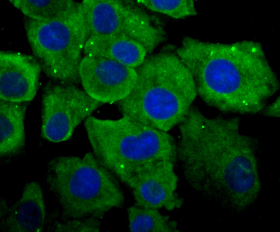 IF(ICC) staining with Cytochrome P450 Oxidoreductase (4F7) Monoclonal Antibody (bsm-54281R) at 1:100 in A549 cells (green). The nuclear counterstain is DAPI (blue). Cells were fixed in paraformaldehyde, permeabilized with 0.25% Triton X100/PBS.