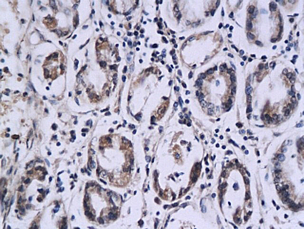 Formalin-fixed and paraffin embedded: mouse small intestine tissue labeled with Anti-PCNA Polyclonal Antibody (bs-0491R), Unconjugated  followed by conjugation to the secondary antibody and DAB staining