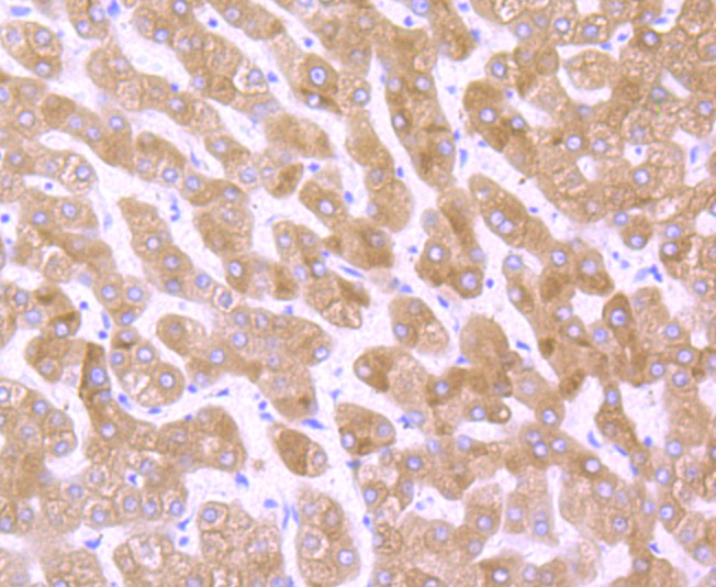 Paraformaldehyde-fixed and paraffin-embedded Human Liver tissue incubated with Cytochrome P450 Oxidoreductase (4F7) Monoclonal Antibody (bsm-54281R) at 1:100, overnight at 4°C, followed by a conjugated secondary antibody and DAB staining. Counterstained with hematoxylin.