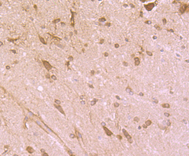 Paraformaldehyde-fixed and paraffin-embedded Rat Brain tissue incubated with Cytochrome P450 Oxidoreductase (4F7) Monoclonal Antibody (bsm-54281R) at 1:100, overnight at 4°C, followed by a conjugated secondary antibody and DAB staining. Counterstained with hematoxylin.