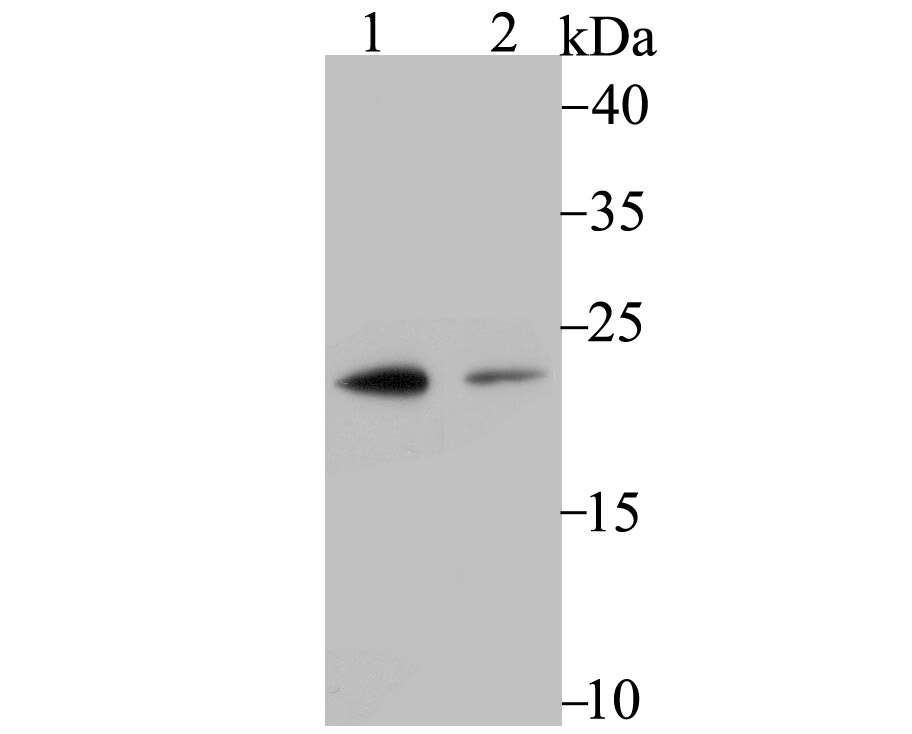 Lane 1: U937 Cells; Lane 2: A431 Cells; Probed with PSMB8 (4A4) Monoclonal Antibody (bsm-54282R) at 1:500 overnight at 4°C followed by a conjugated secondary antibody for 60 minutes at 37°C.