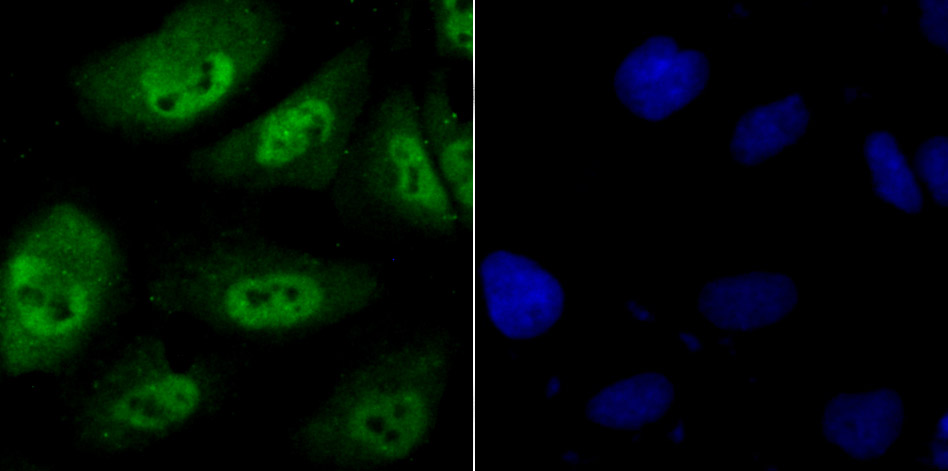 IF(ICC) staining with PSMB8 (4A4) Monoclonal Antibody (bsm-54282R) at 1:100 in HUVEC cells (green). The nuclear counterstain is DAPI (blue). Cells were fixed in paraformaldehyde, permeabilized with 0.25% Triton X100/PBS.