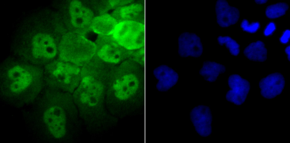 IF(ICC) staining with PSMB8 (4A4) Monoclonal Antibody (bsm-54282R) at 1:100 in A431 cells (green). The nuclear counterstain is DAPI (blue). Cells were fixed in paraformaldehyde, permeabilized with 0.25% Triton X100/PBS.