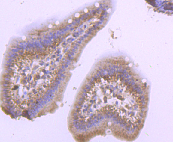 Paraformaldehyde-fixed and paraffin-embedded Mouse Small Intestine tissue incubated with PSMB8 (4A4) Monoclonal Antibody (bsm-54282R) at 1:100, overnight at 4°C, followed by a conjugated secondary antibody and DAB staining. Counterstained with hematoxylin.