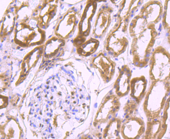 Paraformaldehyde-fixed and paraffin-embedded Human Kidney tissue incubated with PSMB8 (4A4) Monoclonal Antibody (bsm-54282R) at 1:100, overnight at 4°C, followed by a conjugated secondary antibody and DAB staining. Counterstained with hematoxylin.