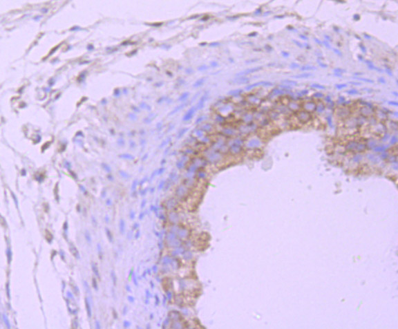 Paraformaldehyde-fixed and paraffin-embedded Rat Epididymis tissue incubated with PSMB8 (4A4) Monoclonal Antibody (bsm-54282R) at 1:100, overnight at 4°C, followed by a conjugated secondary antibody and DAB staining. Counterstained with hematoxylin.