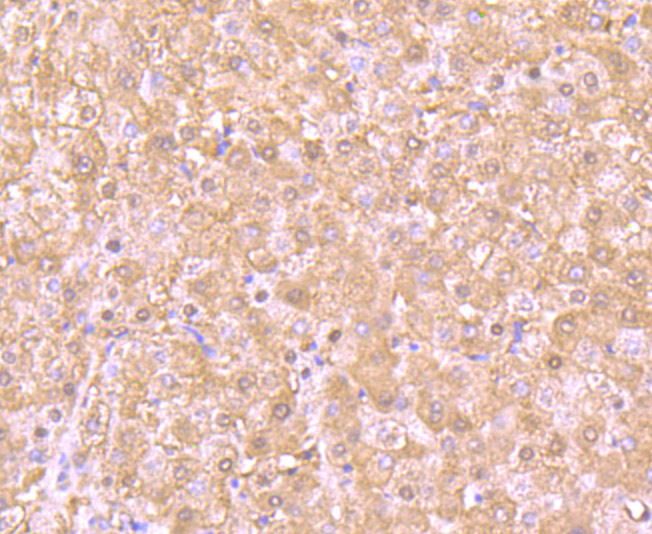 Paraformaldehyde-fixed and paraffin-embedded Human Liver tissue incubated with PSMB8 (4A4) Monoclonal Antibody (bsm-54282R) at 1:100, overnight at 4°C, followed by a conjugated secondary antibody and DAB staining. Counterstained with hematoxylin.
