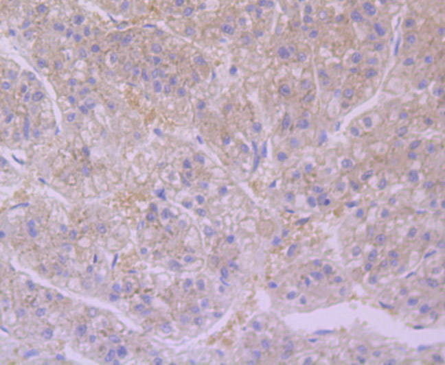 Paraformaldehyde-fixed and paraffin-embedded Human Liver tissue incubated with Furin (8C3) Monoclonal Antibody (bsm-54283R) at 1:100, overnight at 4°C, followed by a conjugated secondary antibody and DAB staining. Counterstained with hematoxylin.