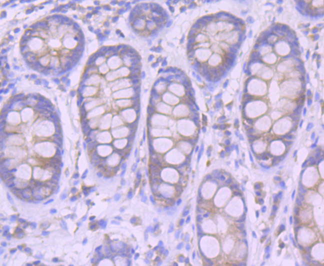 Paraformaldehyde-fixed and paraffin-embedded Human Colon tissue incubated with Furin (8C3) Monoclonal Antibody (bsm-54283R) at 1:100, overnight at 4°C, followed by a conjugated secondary antibody and DAB staining. Counterstained with hematoxylin.