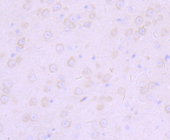 Paraformaldehyde-fixed and paraffin-embedded Mouse Brain tissue incubated with Furin (8C3) Monoclonal Antibody (bsm-54283R) at 1:100, overnight at 4°C, followed by a conjugated secondary antibody and DAB staining. Counterstained with hematoxylin.
