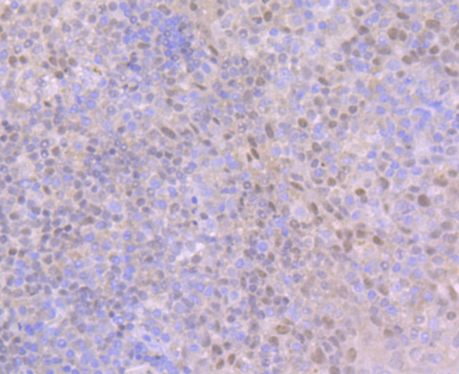 Paraformaldehyde-fixed and paraffin-embedded Human Tonsil tissue incubated with BCL11A (4A11) Monoclonal Antibody (bsm-54284R) at 1:100, overnight at 4°C, followed by a conjugated secondary antibody and DAB staining. Counterstained with hematoxylin.