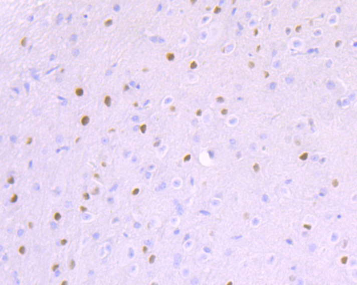 Paraformaldehyde-fixed and paraffin-embedded Mouse Cerebellum tissue incubated with BCL11A (4A11) Monoclonal Antibody (bsm-54284R) at 1:100, overnight at 4°C, followed by a conjugated secondary antibody and DAB staining. Counterstained with hematoxylin.