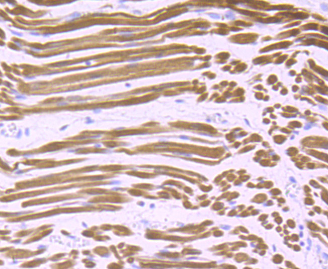 Paraformaldehyde-fixed and paraffin-embedded Human Fetal Skeletal Muscle tissue incubated with Calsequestrin-1 (8G1) Monoclonal Antibody (bsm-54285R) at 1:100, overnight at 4°C, followed by a conjugated secondary antibody and DAB staining. Counterstained with hematoxylin.
