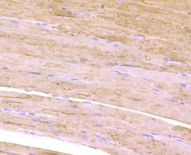 Paraformaldehyde-fixed and paraffin-embedded Mouse Skeletal Muscle tissue incubated with Calsequestrin-1 (8G1) Monoclonal Antibody (bsm-54285R) at 1:100, overnight at 4°C, followed by a conjugated secondary antibody and DAB staining. Counterstained with hematoxylin.