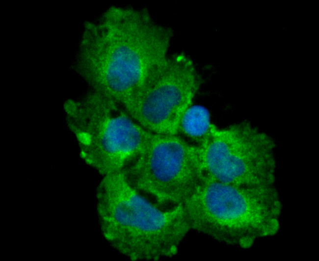 IF(ICC) staining with TGF alpha (1H8) Monoclonal Antibody (bsm-54286R) at 1:100 in A431 cells (green). The nuclear counterstain is DAPI (blue). Cells were fixed in paraformaldehyde, permeabilized with 0.25% Triton X100/PBS.