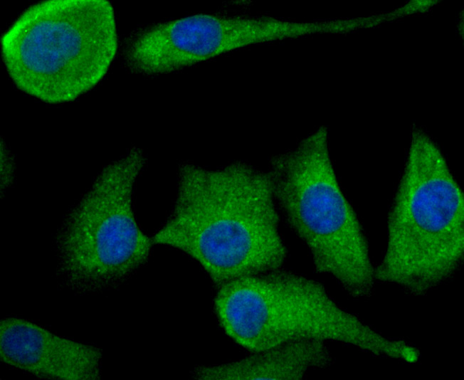 IF(ICC) staining with TGF alpha (1H8) Monoclonal Antibody (bsm-54286R) at 1:100 in A549 cells (green). The nuclear counterstain is DAPI (blue). Cells were fixed in paraformaldehyde, permeabilized with 0.25% Triton X100/PBS.