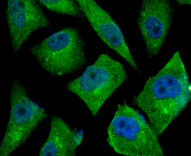 IF(ICC) staining with TGF alpha (1H8) Monoclonal Antibody (bsm-54286R) at 1:100 in PC-3M cells (green). The nuclear counterstain is DAPI (blue). Cells were fixed in paraformaldehyde, permeabilized with 0.25% Triton X100/PBS.