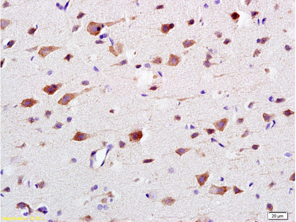 Formalin-fixed and paraffin embedded: rat brain tissue labeled with Anti-CaMK2b Polyclonal Antibody (bs-0541R), Unconjugated at 1:200 followed by conjugation to the secondary antibody and DAB staining