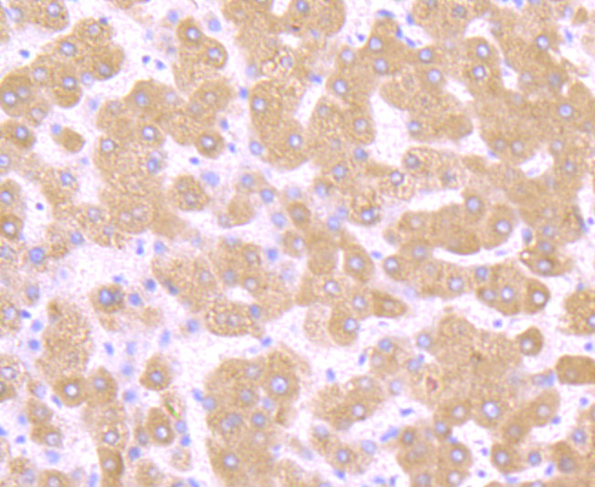 Paraformaldehyde-fixed and paraffin-embedded Human Liver tissue incubated with TGF alpha (1H8) Monoclonal Antibody (bsm-54286R) at 1:100, overnight at 4°C, followed by a conjugated secondary antibody and DAB staining. Counterstained with hematoxylin.