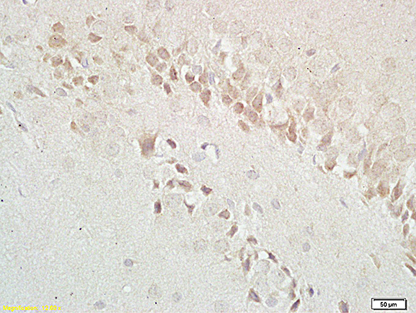 Formalin-fixed and paraffin embedded: rat brain tissue labeled with Anti-GABRB1 Polyclonal Antibody (bs-0533R), Unconjugated at 1:200 followed by conjugation to the secondary antibody and DAB staining