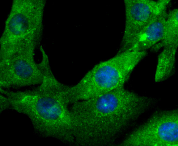 IF(ICC) staining with Gelsolin (2G6) Monoclonal Antibody (bsm-54290R) at 1:100 in NIH-3T3 cells (green). The nuclear counterstain is DAPI (blue). Cells were fixed in paraformaldehyde, permeabilized with 0.25% Triton X100/PBS.