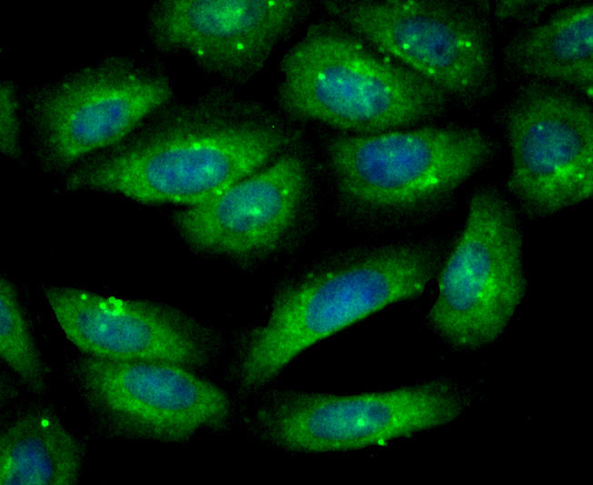 IF(ICC) staining with Gelsolin (2G6) Monoclonal Antibody (bsm-54290R) at 1:100 in SiHa cells (green). The nuclear counterstain is DAPI (blue). Cells were fixed in paraformaldehyde, permeabilized with 0.25% Triton X100/PBS.