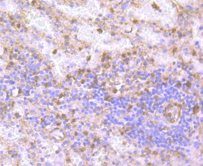 Paraformaldehyde-fixed and paraffin-embedded Human Spleen tissue incubated with Gelsolin (2G6) Monoclonal Antibody (bsm-54290R) at 1:100, overnight at 4°C, followed by a conjugated secondary antibody and DAB staining. Counterstained with hematoxylin.