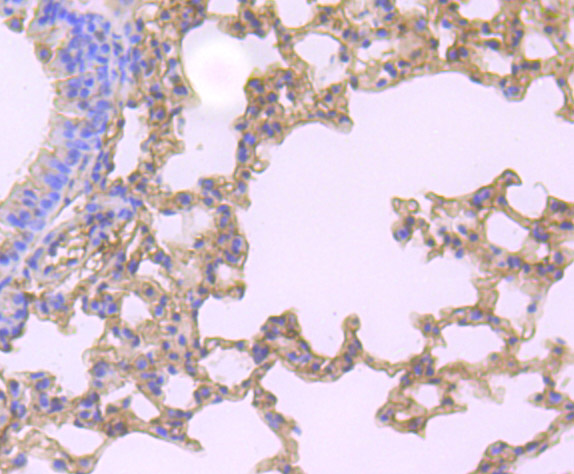 Paraformaldehyde-fixed and paraffin-embedded Mouse Lung tissue incubated with Gelsolin (2G6) Monoclonal Antibody (bsm-54290R) at 1:100, overnight at 4°C, followed by a conjugated secondary antibody and DAB staining. Counterstained with hematoxylin.