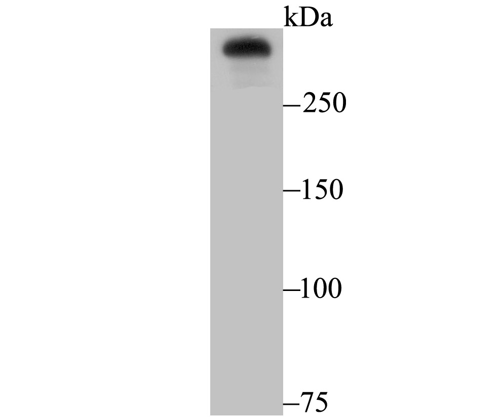Lane 1: A431 Cells; Probed with Huntingtin (1F10) Monoclonal Antibody (bsm-54305R) at 1:500 overnight at 4°C followed by a conjugated secondary antibody for 60 minutes at 37°C.