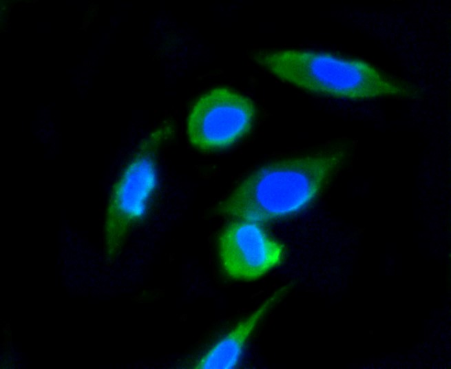 IF(ICC) staining with Ubiquitin (7C6) Monoclonal Antibody (bsm-52447R) at 1:100 in SH-SY5Y cells (green). The nuclear counterstain is DAPI (blue). Cells were fixed in paraformaldehyde, permeabilized with 0.25% Triton X100/PBS.