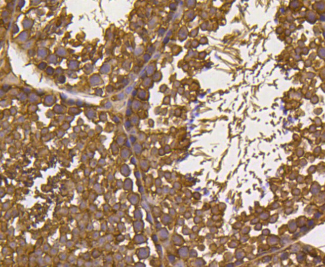 Paraformaldehyde-fixed and paraffin-embedded Mouse testis tissue incubated with Ubiquitin (7C6) Monoclonal Antibody (bsm-52447R) at 1:300, overnight at 4°C, followed by a conjugated secondary antibody and DAB staining. Counterstained with hematoxylin.