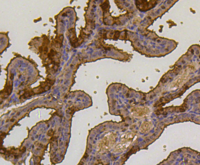 Paraformaldehyde-fixed and paraffin-embedded Mouse placenta tissue incubated with Ubiquitin (7C6) Monoclonal Antibody (bsm-52447R) at 1:300, overnight at 4°C, followed by a conjugated secondary antibody and DAB staining. Counterstained with hematoxylin.