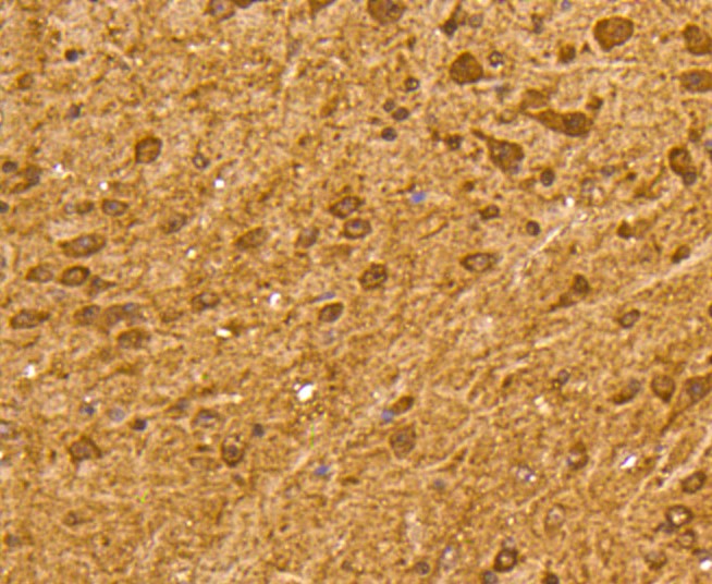 Paraformaldehyde-fixed and paraffin-embedded Mouse brain tissue incubated with Ubiquitin (7C6) Monoclonal Antibody (bsm-52447R) at 1:300, overnight at 4°C, followed by a conjugated secondary antibody and DAB staining. Counterstained with hematoxylin.