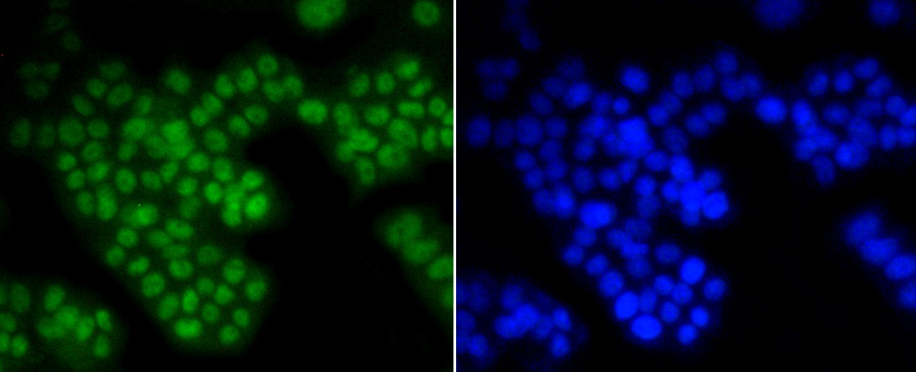 IF(ICC) staining with ASH2L (1B6) Monoclonal Antibody (bsm-52448R) at 1:300 in PC-12 cells (green). The nuclear counterstain is DAPI (blue). Cells were fixed in paraformaldehyde, permeabilized with 0.25% Triton X100/PBS.